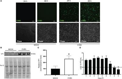 Coxsackievirus B3 infects and disrupts human induced-pluripotent stem cell derived brain-like endothelial cells